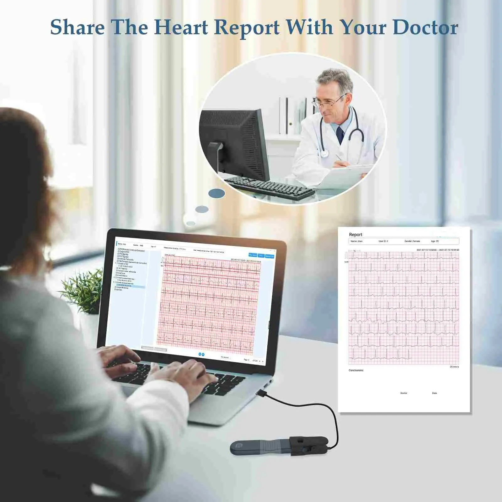 Checkme ER1 24 Hours AI ECG Holter