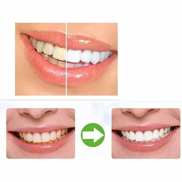 Teeth Whitening Charcoal Powder