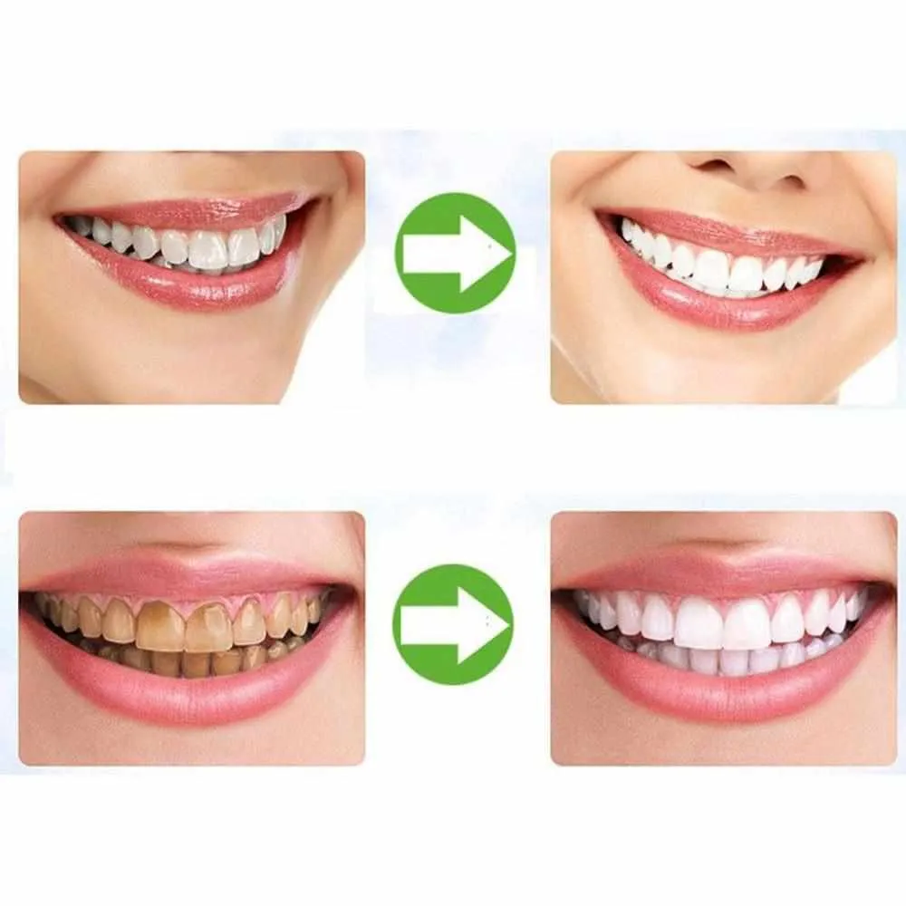 Teeth Whitening Charcoal Powder